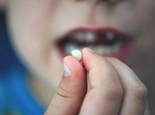 تفسير حلم سقوط الأسنان بين طول العمر وفقد الأحبة