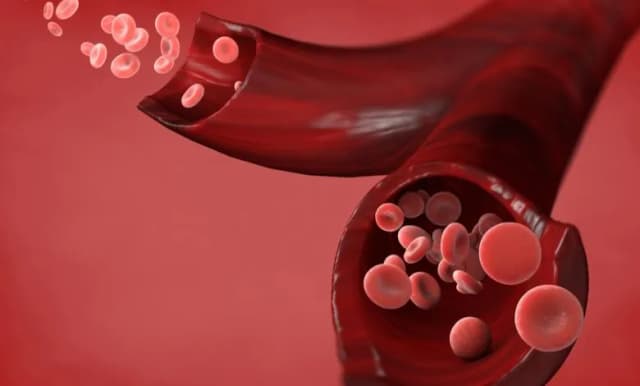 تفسير حلم الدم في المنام- مال حرام، كذب، أم حياة؟